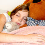 young girl with early stages of the measles rash taking a nap